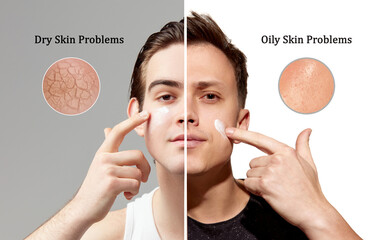 Dry skin vs oily ski problems. Young men with different skin types using cream for nutrition, moisturizing and healthy looking face. Concept of skincare, natural beauty, cosmetology, cosmetics, ad
