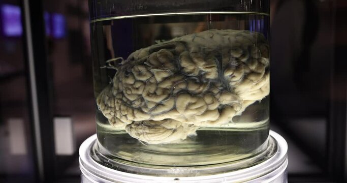 Human brain in glass jar with formaldehyde for medical research