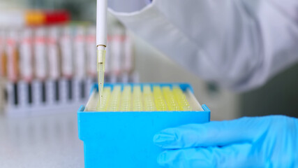 Medical development laboratory: A scientist uses a micropipette, fills a test tube with liquid and performs an experiment. Pharmaceutical laboratory of medicine and biotechnology