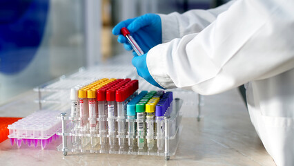 Modern loborothyria. The scientist examines the test tubes. Organized test tubes with scientific samples and substances in them, intended for scientific research.