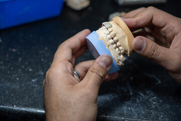 Dental gypsum models in dental laboratory with single tooth crown to be tested for Teeth occlude...