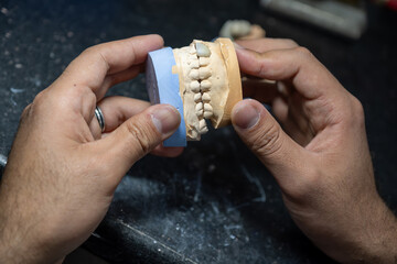 Dental gypsum models in dental laboratory with single tooth crown to be tested for Teeth occlude...