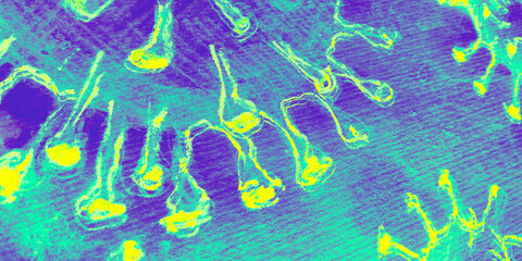 Mold Illustration. Lime Immune Diseases