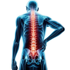 Human backbone in x-ray, back Pain, on a transparent background - obrazy, fototapety, plakaty