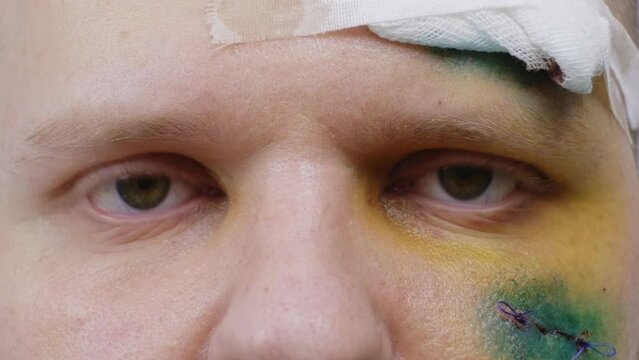 A wounded man with a stitched incision and a medical bandage on his forehead looks into the camera. Close-up of the eyes. The concept of the consequences of a car accident or beating