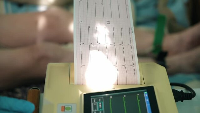 The doctor makes a cardiogram that is printed with the finished result to the patient lying on the medical couch. The result is printed on paper with a close-up conclusion. Diagnostics of the heart