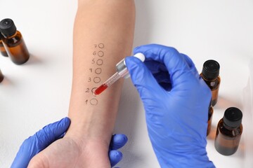 Doctor doing skin allergy test at light table, closeup