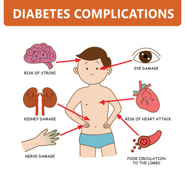Diabetes complications with man symptom infographic cartoon illustration on white background