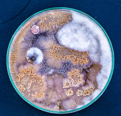 colonies of bacteria and microorganisms on the surface of agar and wind during microbiological...