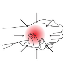 line art illustration of hands feeling cramps, pain, bruises on the back of the palms.