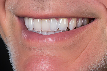 Obraz premium Male smile with white teeth close-up