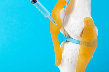 Intra-articular injection of anti-inflammatory medication into a mock-up knee joint on a blue...