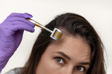millennial woman using mezoroller with needles against hair loss,on scalp.girl with pills blisters...