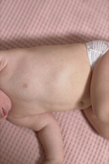 Roseola of the course of the disease in the baby, rash on the skin, the baby is capricious and sluggish