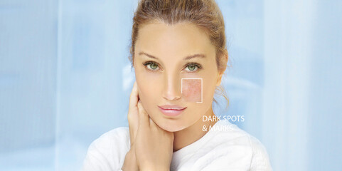 Skin solutions.Concept of rejuvenation.skin with acne scars and age spots