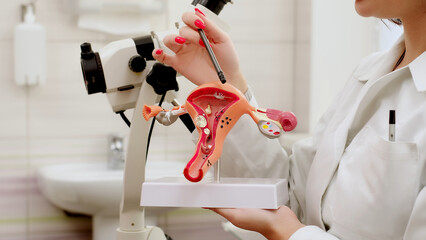 A gynecologist explains female diseases to a patient using a plastic model of the uterus and...