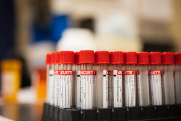 Medical blood draw vials. 
