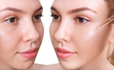 Woman before and after applying cosmetics remedy on face skin.