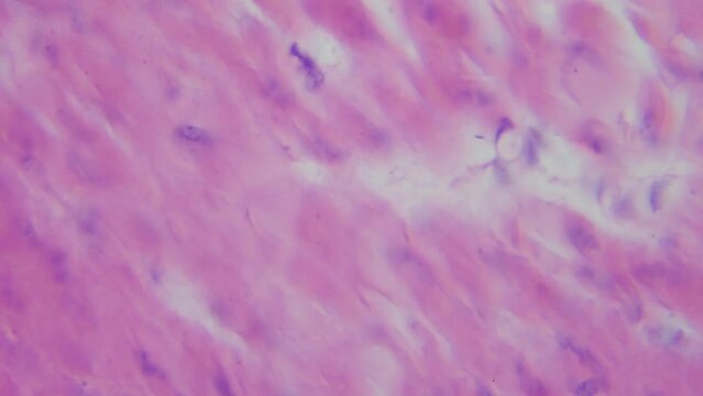 Thin section of human stomach with contrast under a microscope. Morphologic examination of a sample of the stomach wall. Detection of malignant gastric tumors. Intestinal resection.  400x and 1000x