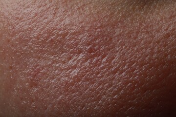 Closeup view of human oily skin as background