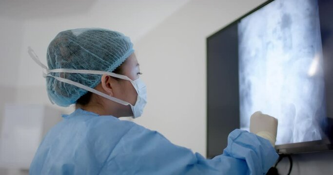 Asian female surgeon looking at x-ray scans in operating theatre, slow motion