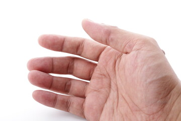 Warts in medical terms are called Papillomas. Papilloma is actually a type of benign tumor on the...