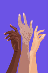 Hands of different races and ethnicities. United for equality. Vector drawing.