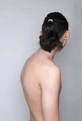 Incorrect position of the spine in an adult boy. Stooped back and unhealthy spine. Scoliosis