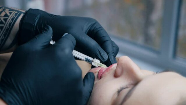 lip augmentation procedure. close-up, female lips. Male surgeon injectionist carefully and slowly injects hyaluronic acid into woman's lips with a syringe. beauty injections. Plastic surgery.