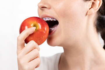 Close up of young Caucasian smiling woman with braces biting off red apple. White background....