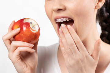 Close up of shocked woman with braces shows red apple with lost brackets locks. White background....