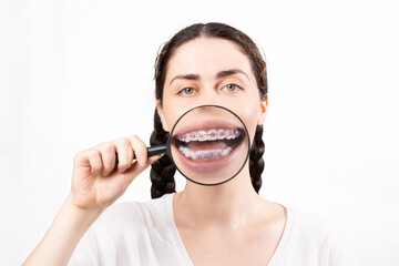 Portrait of smiling woman with braces on her teeth, magnified through magnifying glass. White background. Concept of orthodontic treatment