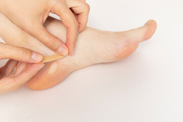 Person Applies Adhesive Plaster On Foot Calluses, Skin Corns on Heel and Phalange of Toe. Water...