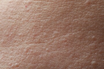 Closeup view of human skin as background