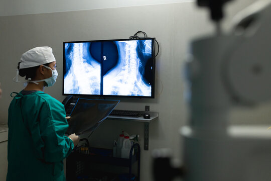 Asian female surgeon looking at x-ray scans on screen in operating theatre at hospital, copy space