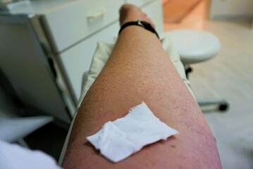 Abgestützter ausgestreckter Arm von Patientin mit weißem Wattepad nach Blutabnahme in Arztpraxis 