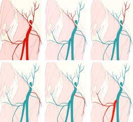 external iliac artery