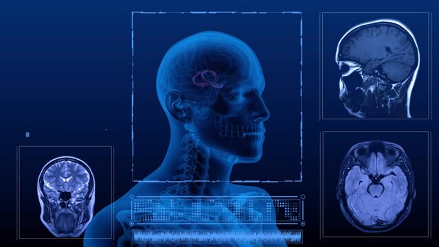 Magnetic resonance scan of the human head. 3d rendering computer animation of X-ray Brain fornix cerebri scans in different projections.