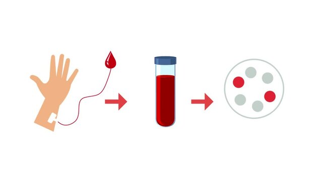 A tube filled with blood for the injection of platelet-rich plasma. PRP blood composition for vampire face. Stem cell regenerative medicine concept. Medical animation cartoon. Plasma lifting.