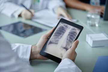 Close up of unrecognizable doctor holding digital tablet with chest X ray image on screen during meeting in clinic, copy space - obrazy, fototapety, plakaty