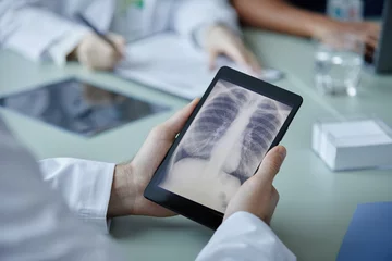 Poster Close up of unrecognizable doctor holding digital tablet with chest X ray image on screen during meeting in clinic, copy space © Seventyfour