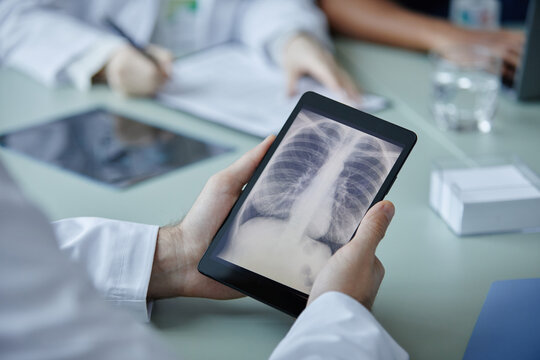 Close up of unrecognizable doctor holding digital tablet with chest X ray image on screen during meeting in clinic, copy space