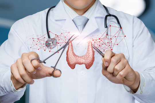 The concept of surgical treatment of the thyroid gland .