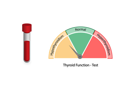 Thyroid function test, Thyroid gland. Hypothyroidism and hyperthyroidism. TSH, T3, T4 hormones. Thyroglobulin, Thyroid peroxidase and Thyroid stimulating hormone receptor antibodies. Vector design.