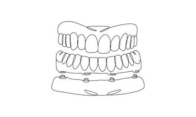 Denture. Lower jaw. One line