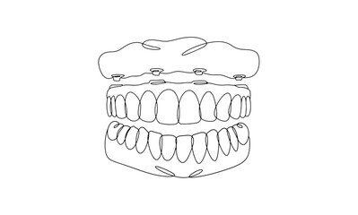 Denture. Upper jaw. One line - obrazy, fototapety, plakaty