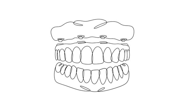 Denture. Upper jaw. One line