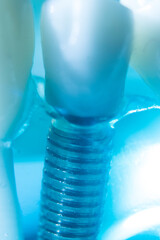 Dental tooth implant