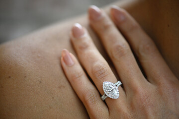 Engagement ring on hand, Ring on hand