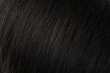 Closeup view of dark woman`s hair with dandruff